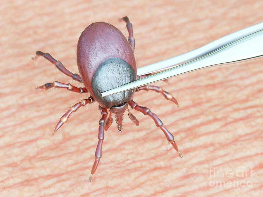 Pest Photograph - Illustration Of A Tick Being Removed by Sebastian Kaulitzki/science Photo Library Pest Photograph - Illustration Of A Tick Being Removed by Sebastian Kaulitzki/science Photo Library