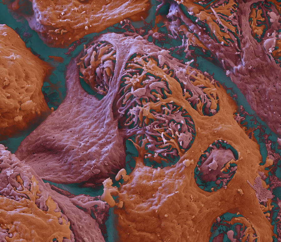 Kidney Glomerulus, Sem #7 Photograph by Oliver Meckes EYE OF SCIENCE