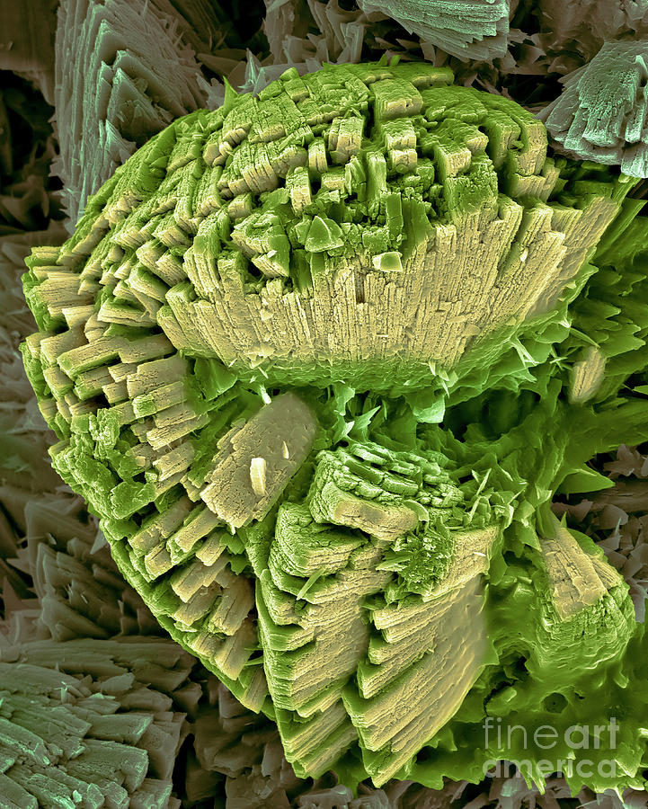 Kidney Stone #7 Photograph by Dennis Kunkel Microscopy/science Photo Library