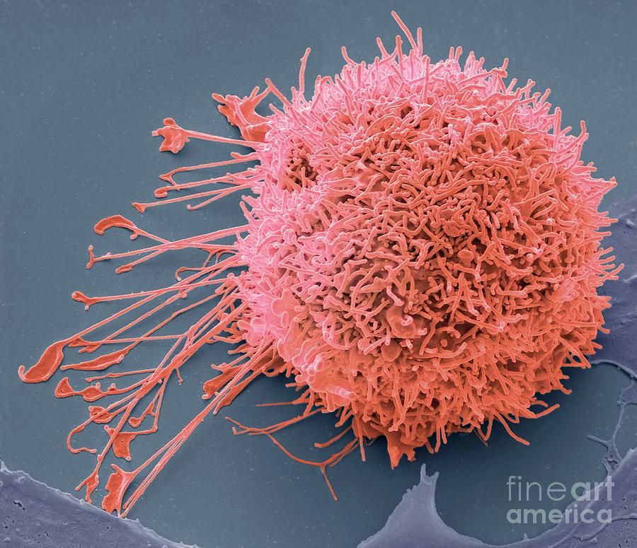 Liver Cancer Cell Photograph by Steve Gschmeissner/science Photo Library