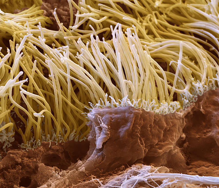 Lung Lining Sem #7 Photograph by Meckes/ottawa