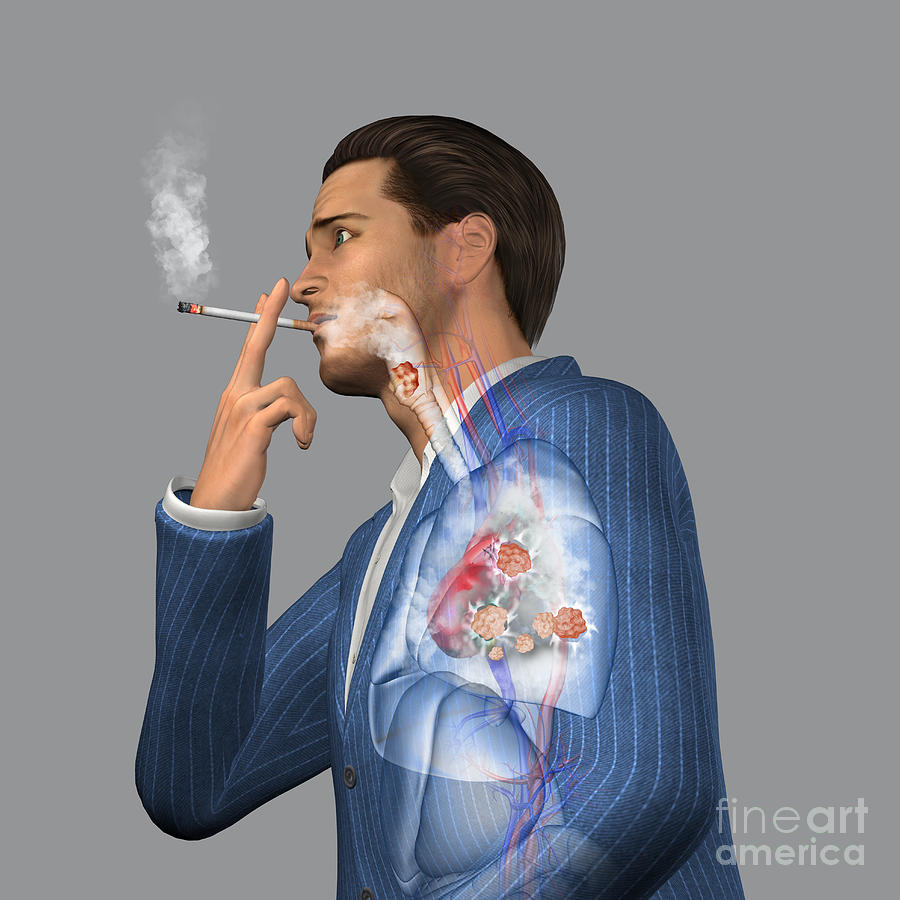 Man Smoking Cigarettes #7 Photograph by Fernando Da Cunha/science Photo Library