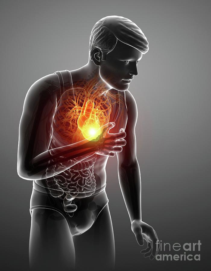 Man With Chest Pain #7 by Pixologicstudio/science Photo Library