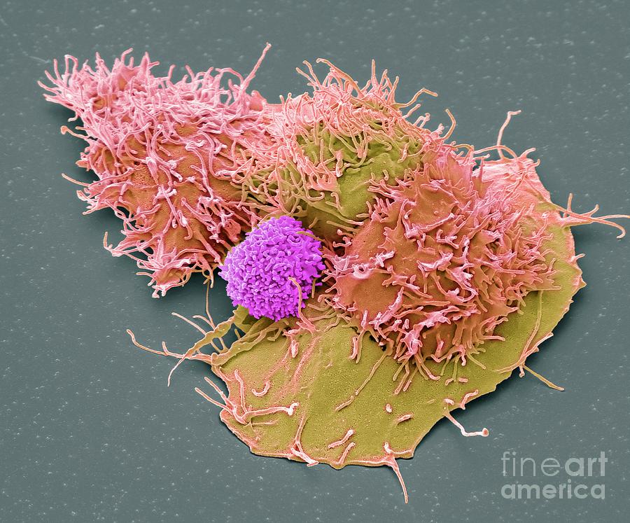 Natural Killer Cell And Cancer Cell Photograph By Steve Gschmeissner Science Photo Library