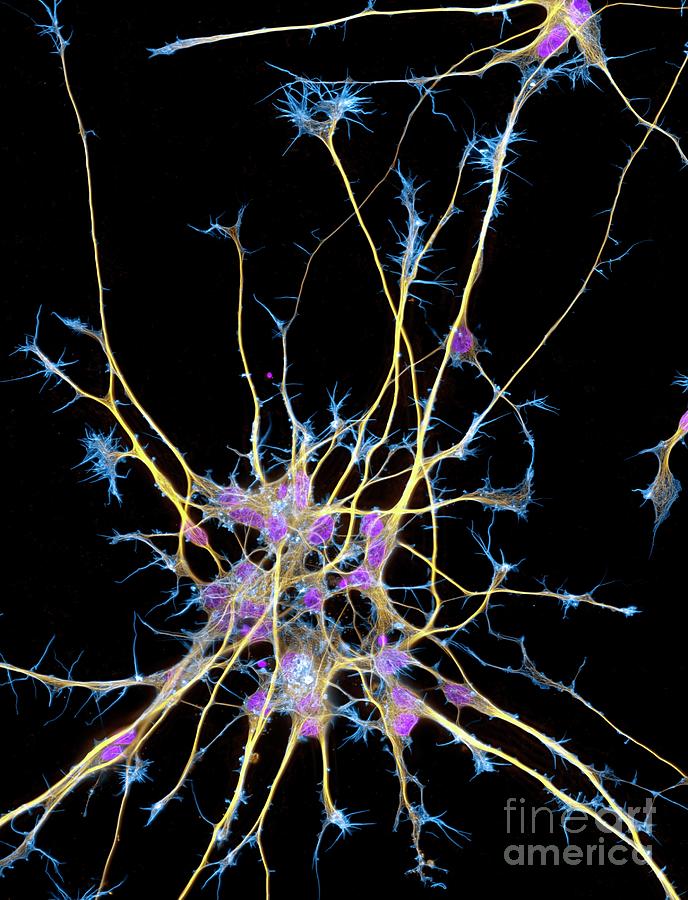 Neurons From Stem Cells #7 Photograph by Dr Torsten Wittmann/science Photo Library