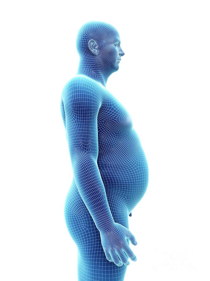 obese figure
