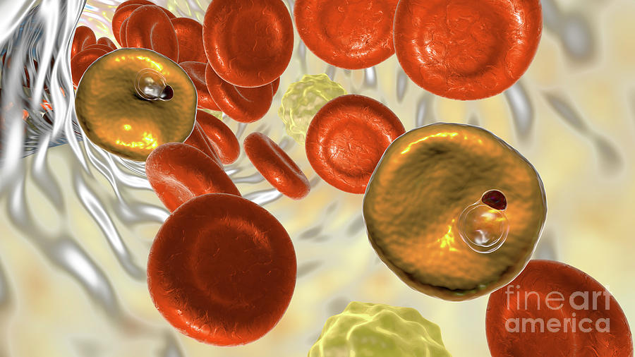 Plasmodium Vivax Inside Red Blood Cells #7 Photograph by Kateryna Kon/science Photo Library