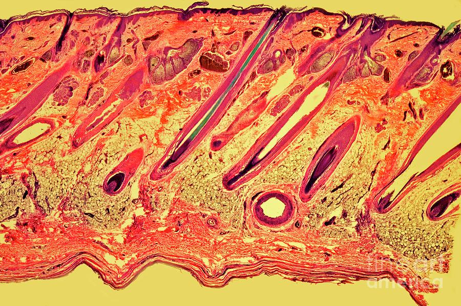 Skin #7 Photograph by Dr Keith Wheeler/science Photo Library