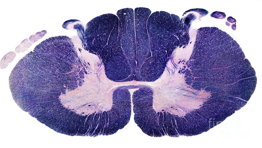 Spinal Cord #7 Photograph by Steve Gschmeissner/science Photo Library ...