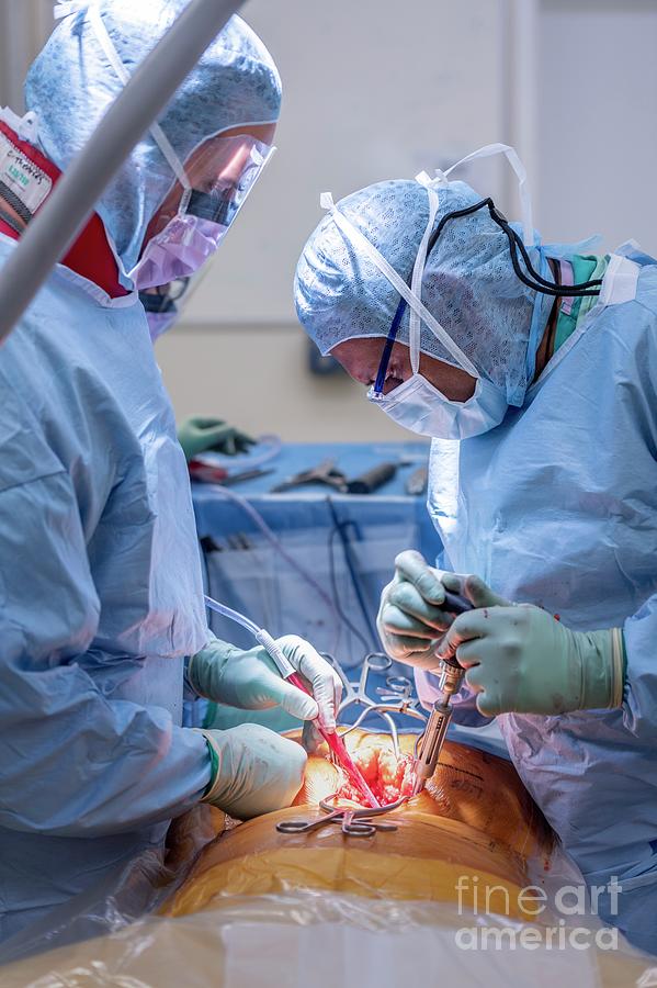 Spinal Surgeons Performing An Operation #7 Photograph by Jim Varney/science Photo Library