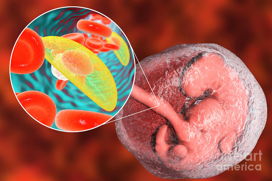 Transplacental Transmission Of Toxoplasmosis Photograph by Kateryna Kon
