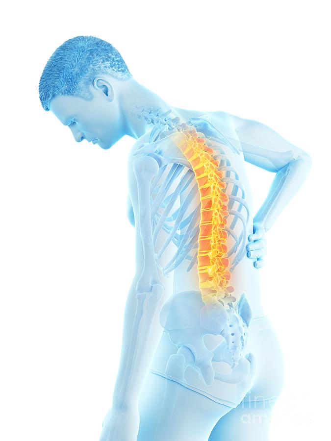 Skeleton Photograph - Back Pain #79 by Sebastian Kaulitzki/science Photo Library