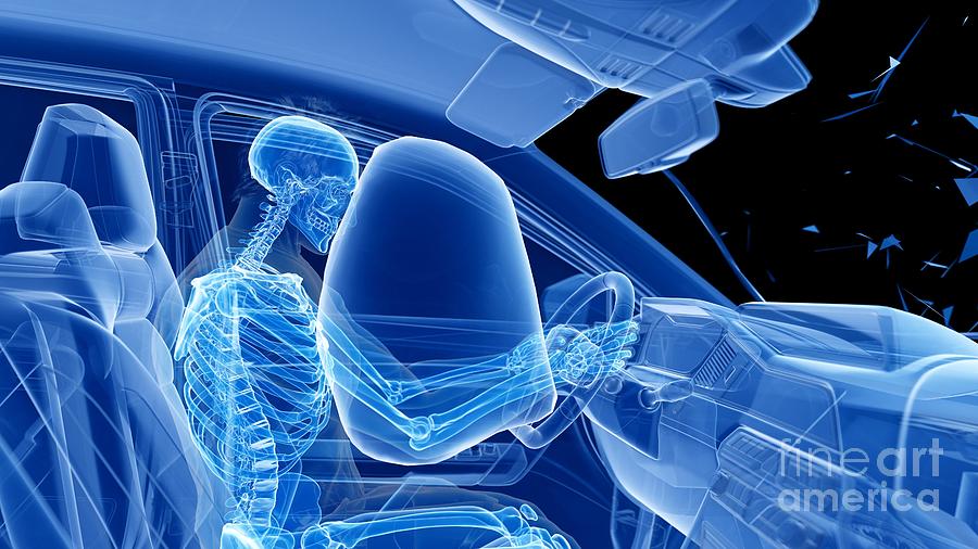 Skeleton Photograph - Airbag Deployed In Car Crash #8 by Sebastian Kaulitzki/science Photo Library
