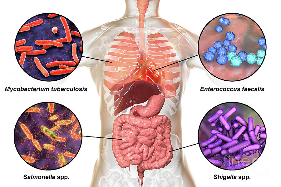 Bacteria That Cause Human Infections Photograph By Kateryna Kon Science Photo Library Fine Art