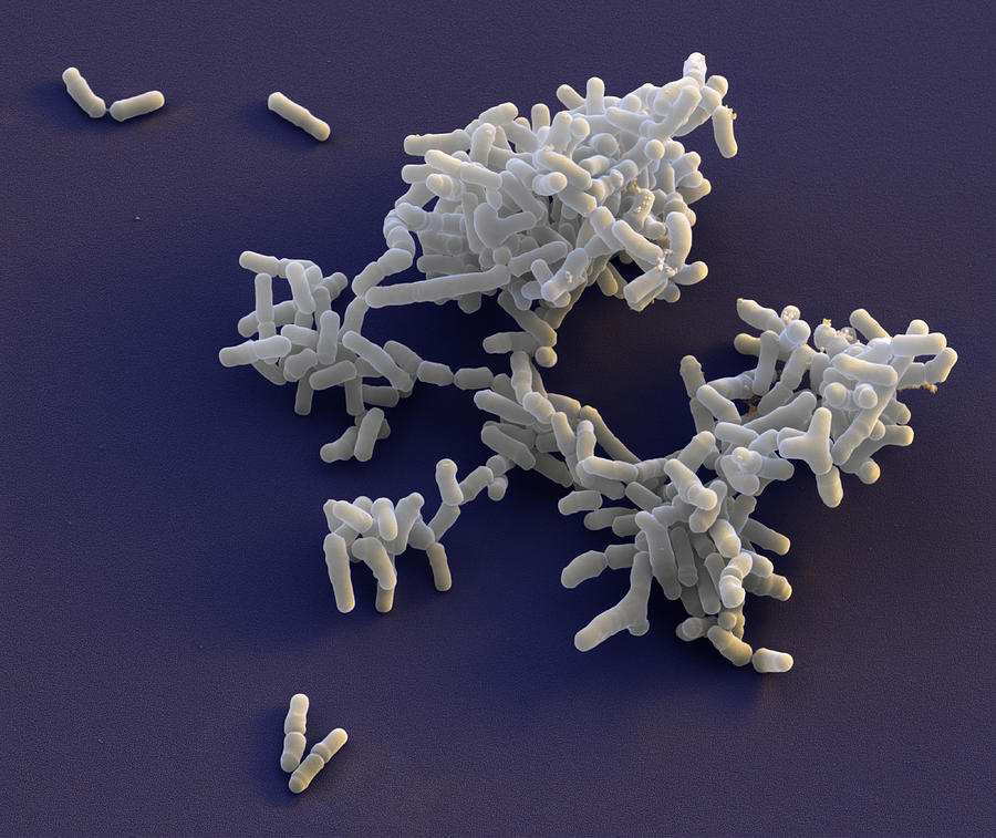 Bifidobacterium Breve, Sem #8 Photograph by Meckes/ottawa