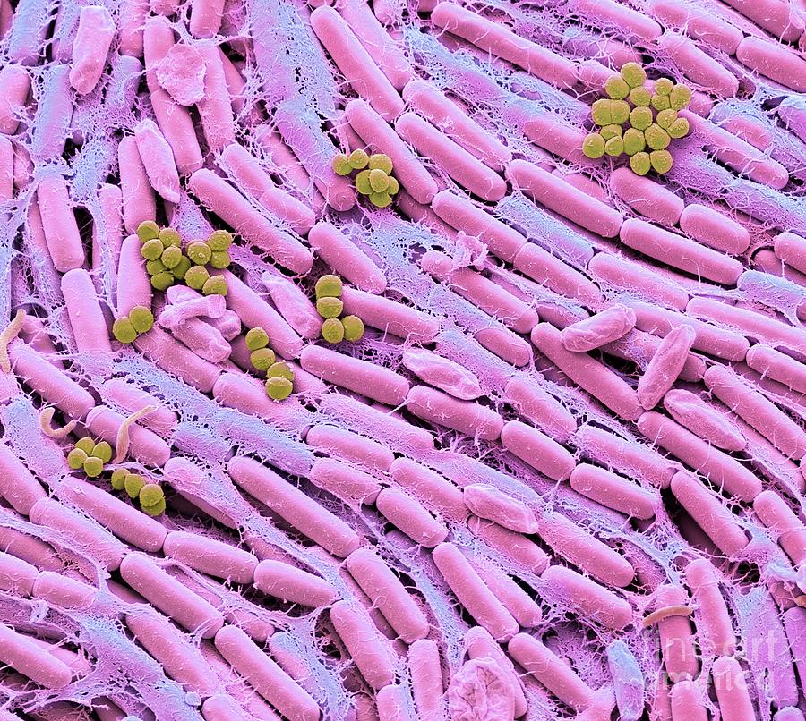 Breast Milk Bacteria #8 Photograph by Steve Gschmeissner/science Photo Library