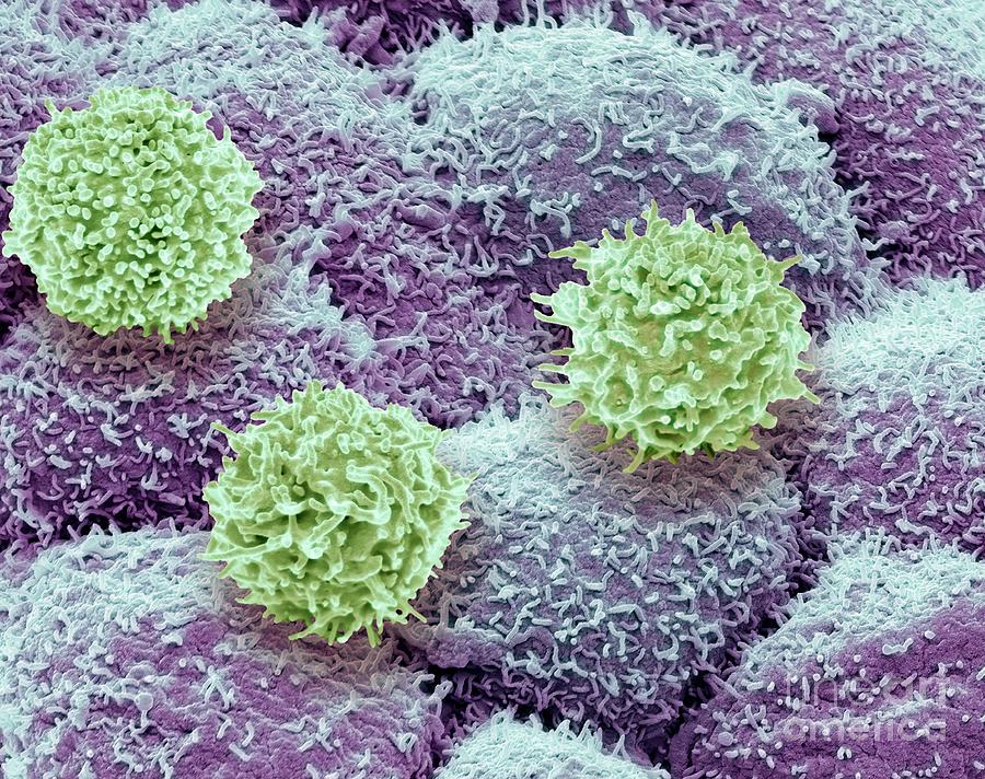 Car Photograph - Car T-cell Therapy #8 by Steve Gschmeissner/science Photo Library
