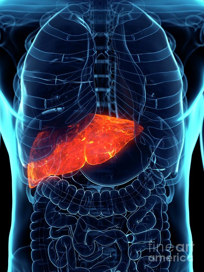 Diseased Liver Photograph by Sebastian Kaulitzki/science Photo Library ...