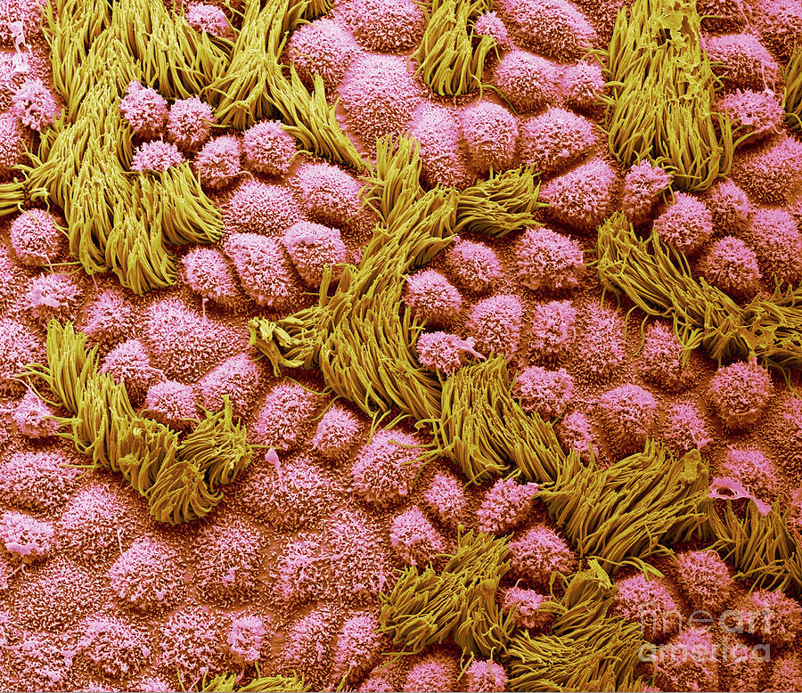 Fallopian Tube #8 Photograph by Steve Gschmeissner/science Photo Library