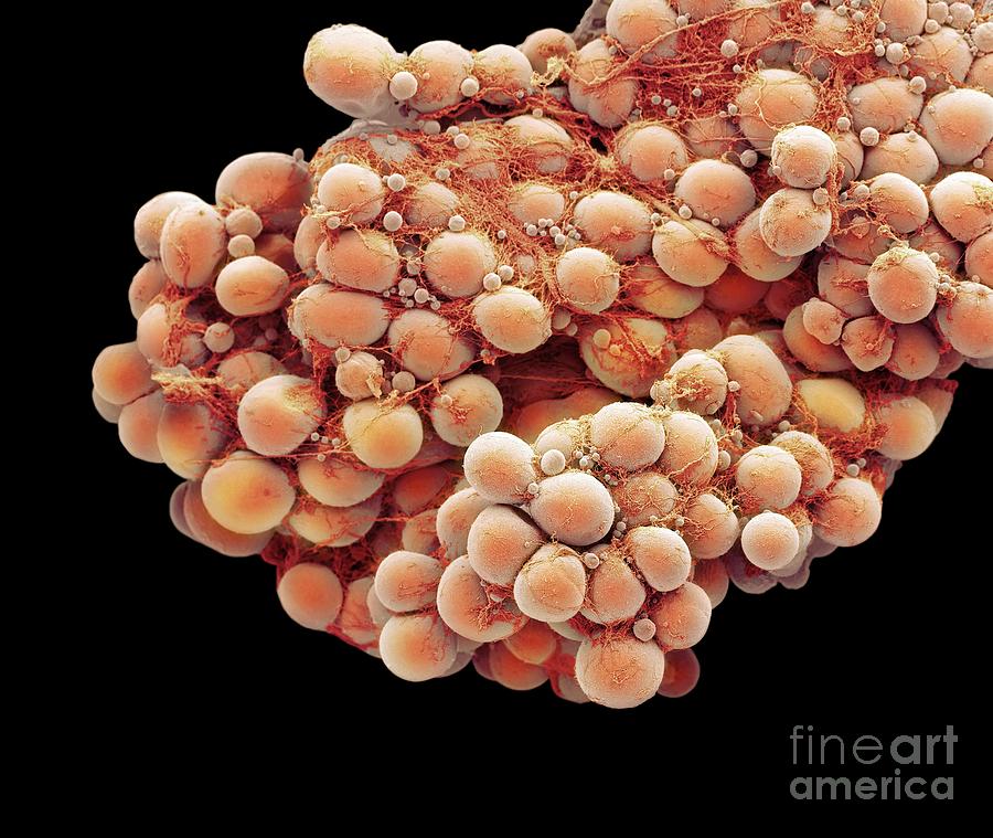 Fat Cells #8 Photograph by Steve Gschmeissner/science Photo Library