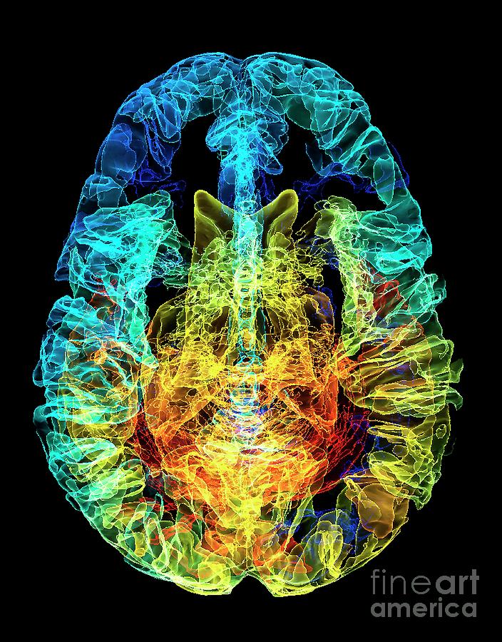 Organ Photograph - Human Brain #8 by K H Fung/science Photo Library