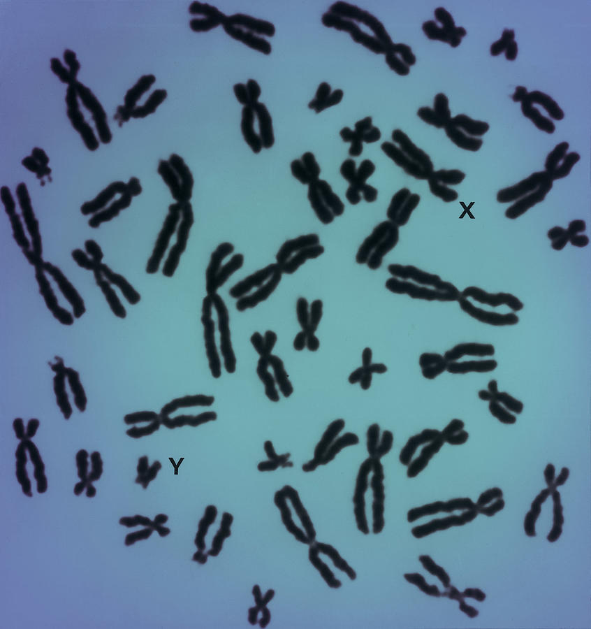 Human Chromosomes #8 Photograph by Biophoto Associates