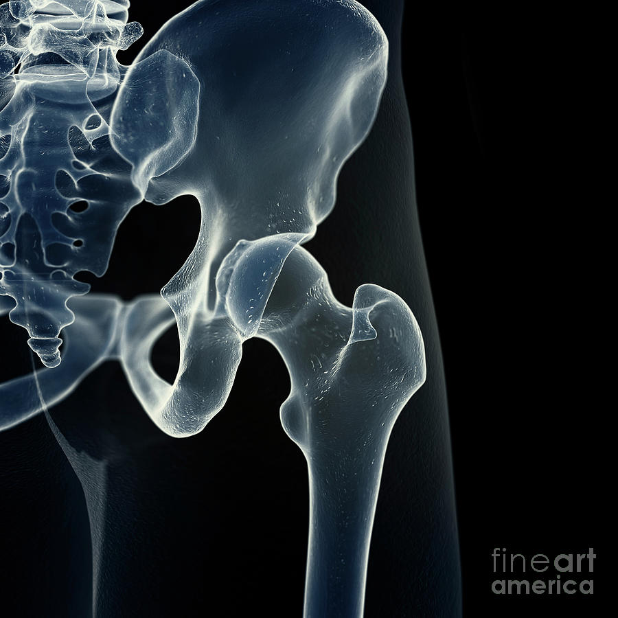 Illustration Of The Hip Joint #8 Photograph by Sebastian Kaulitzki ...