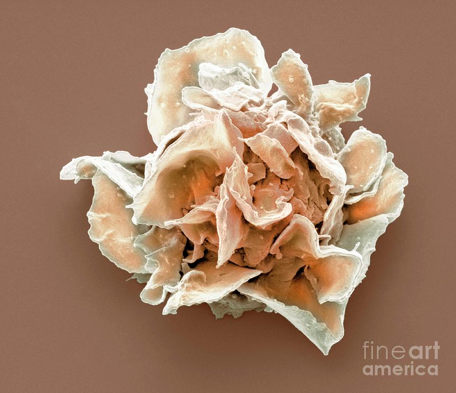 Jurkat Cell Photograph by Steve Gschmeissner/science Photo Library Pixels