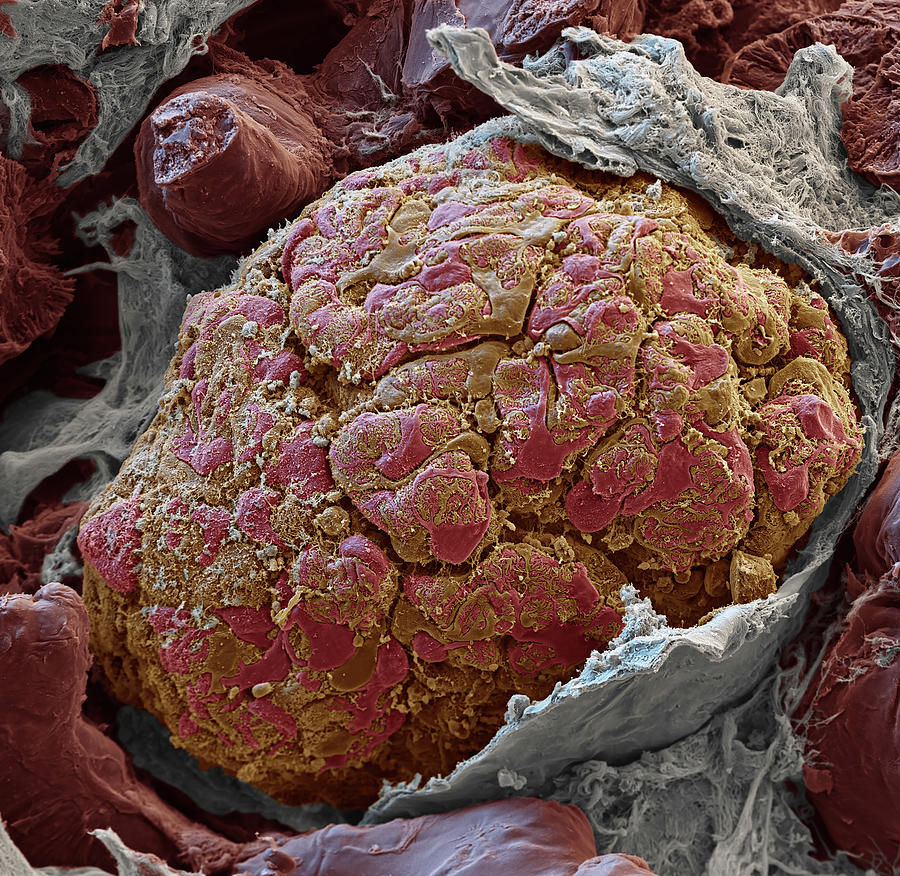 Kidney Glomerulus, Sem #8 Photograph by Oliver Meckes EYE OF SCIENCE