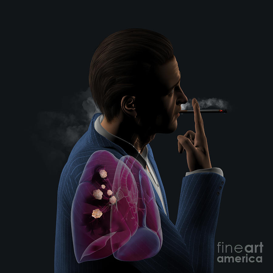 Man Smoking Cigarettes #8 Photograph by Fernando Da Cunha/science Photo Library