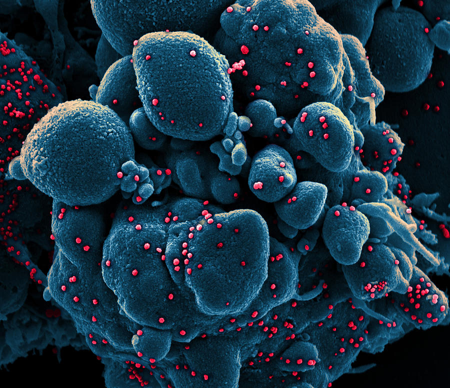 Sars-cov-2, Covid-19 Virus, Sem #8 Photograph by Science Source