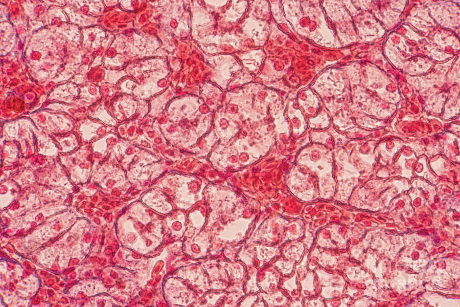 Squamous Epithelial Cells Photograph by Choksawatdikorn / Science Photo