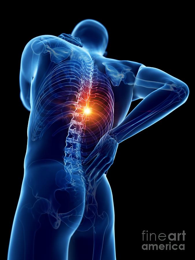 Skeleton Photograph - Back Pain #83 by Sebastian Kaulitzki/science Photo Library
