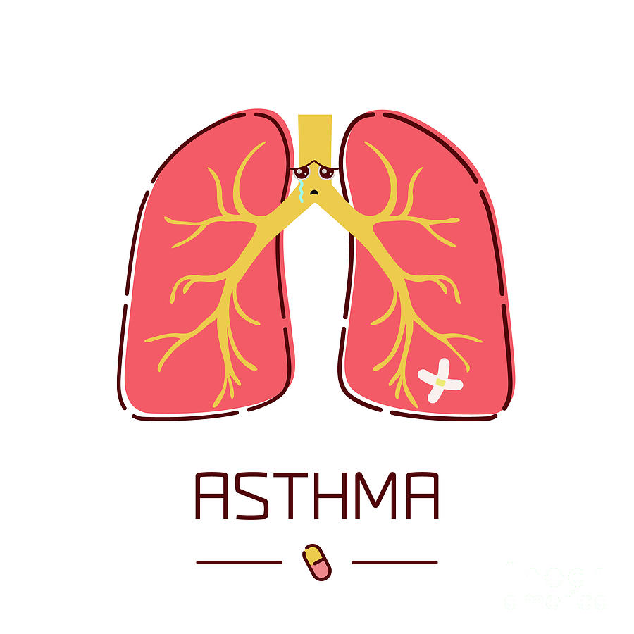 Asthma Photograph by Art4stock/science Photo Library | Pixels