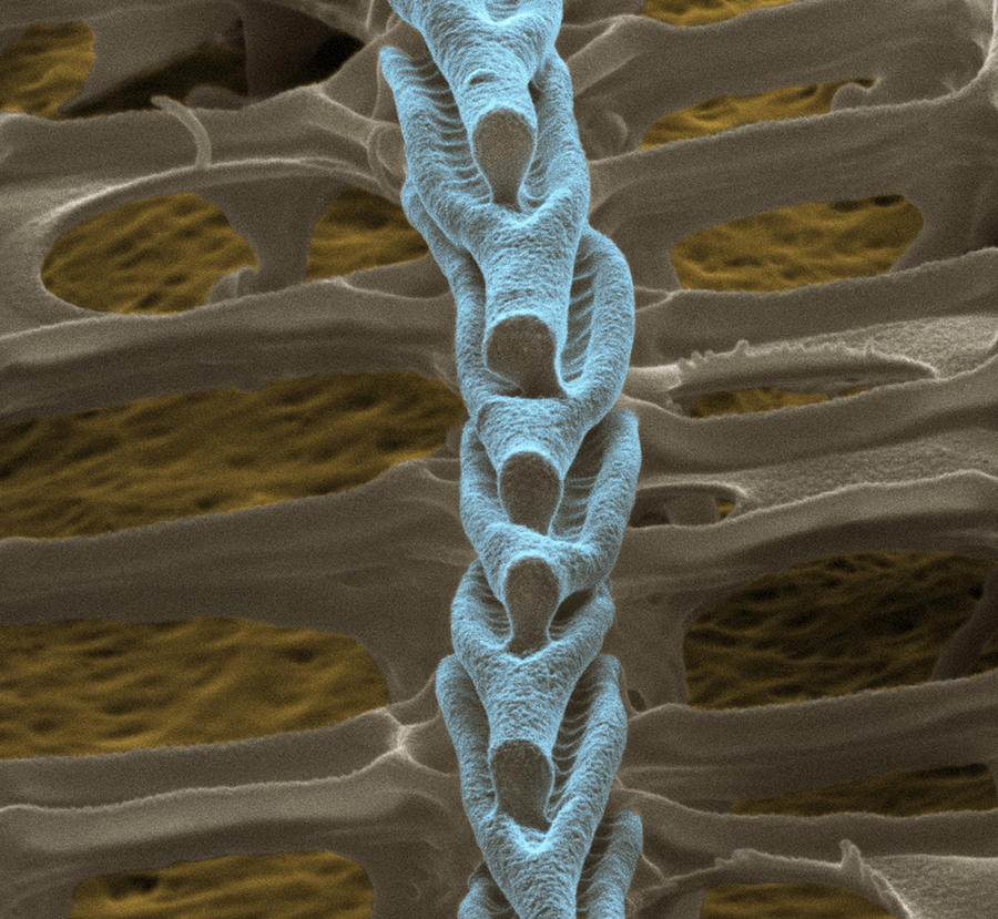 Butterfly Wing Scale Sem #9 Photograph by Meckes/ottawa