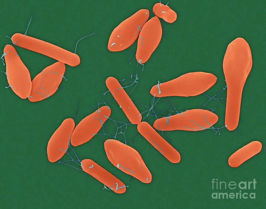 Clostridium Botulinum #9 by Dennis Kunkel Microscopy/science Photo Library