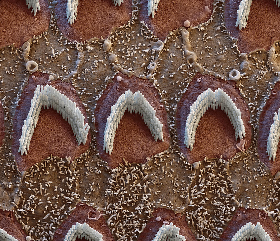 Cochlea, Outer Hair Cells, Sem #9 Photograph by Oliver Meckes EYE OF SCIENCE