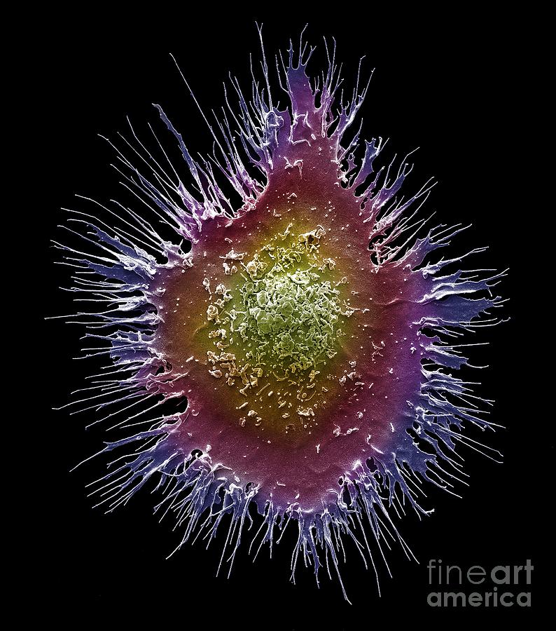 Dendritic Cell #9 Photograph by Steve Gschmeissner/science Photo Library