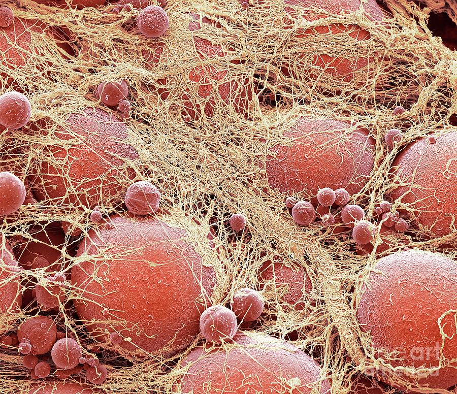 Fat Cells #9 Photograph by Steve Gschmeissner/science Photo Library