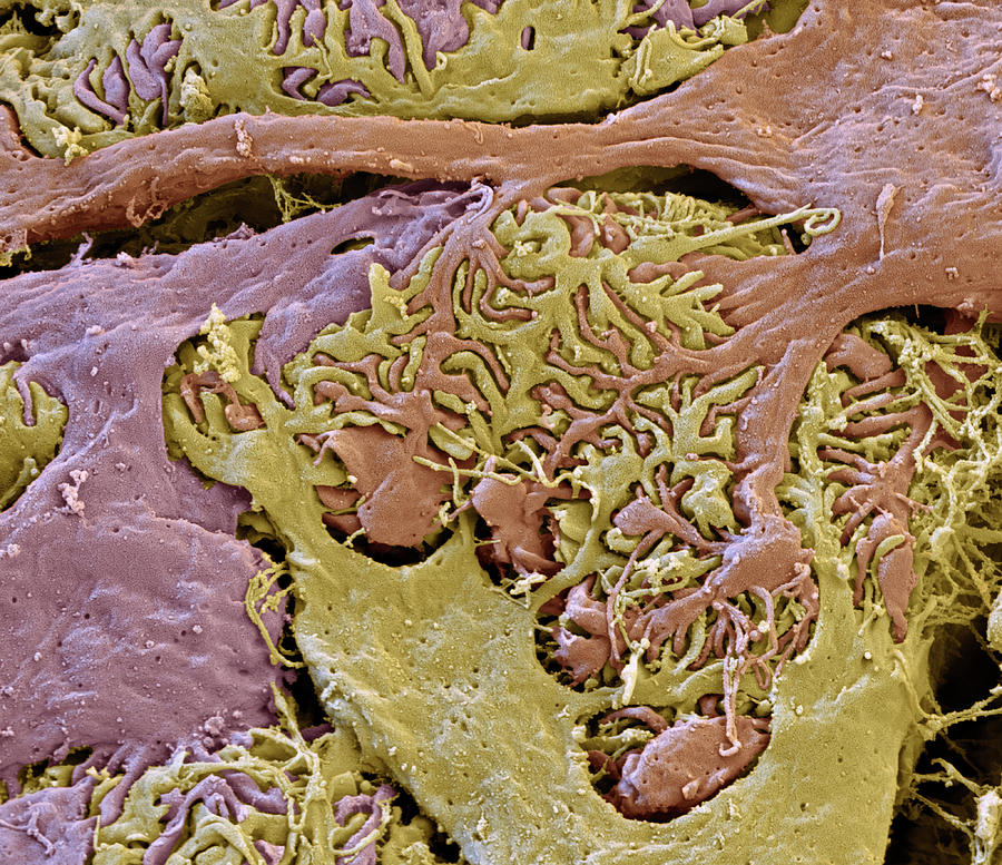 Kidney Glomerulus, Sem #9 Photograph by Oliver Meckes EYE OF SCIENCE