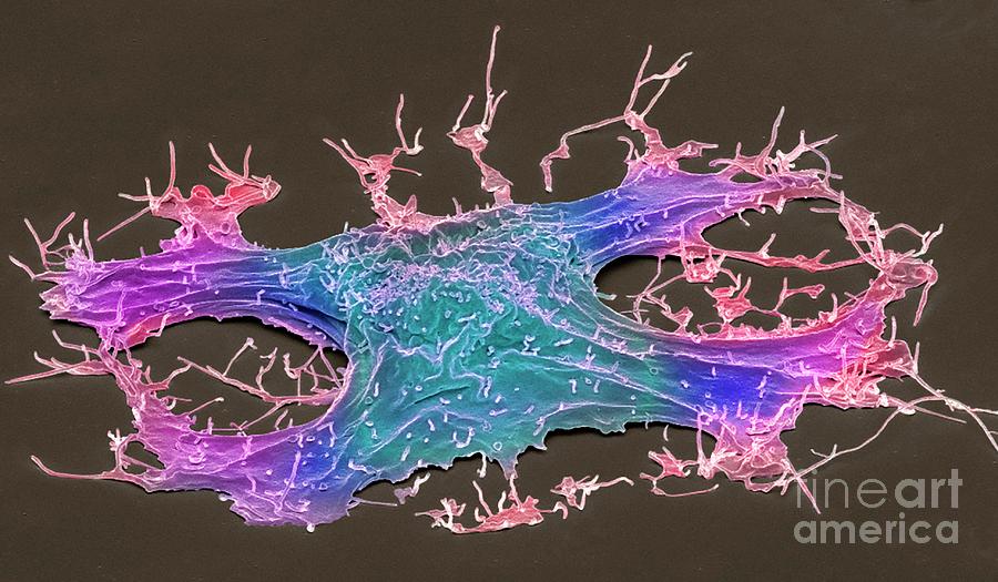 Lung Cancer Cell #9 Photograph by Steve Gschmeissner/science Photo Library