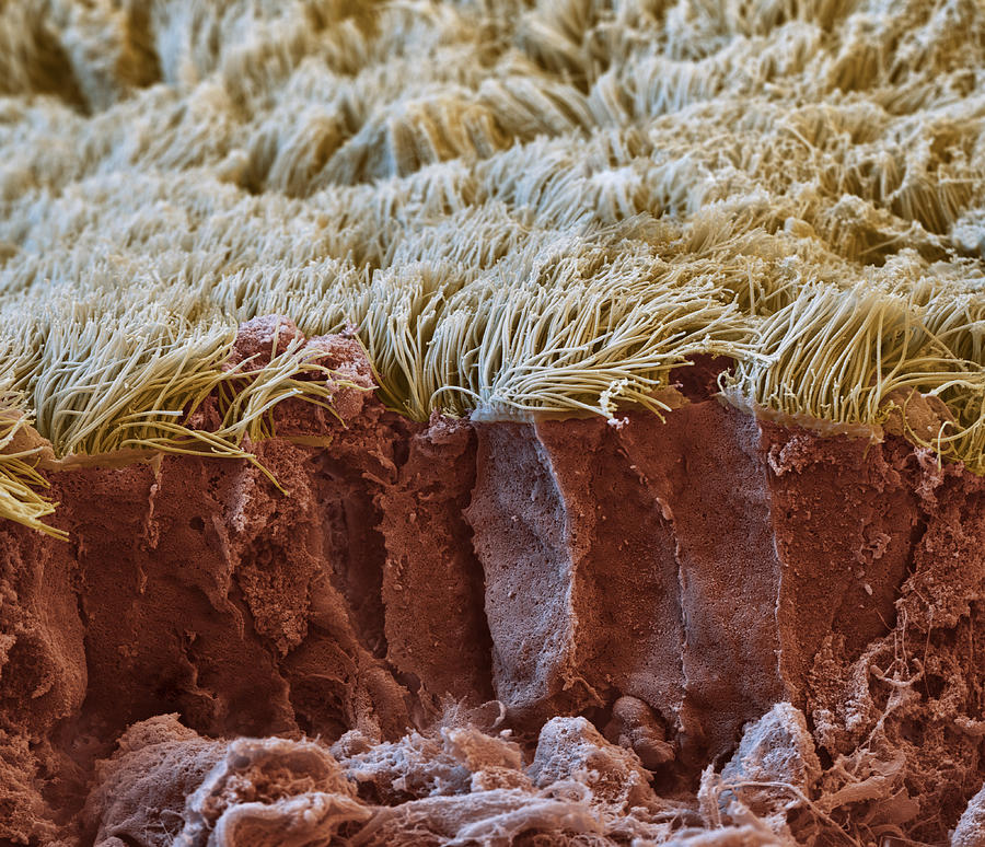 Lung Lining Sem #9 Photograph by Meckes/ottawa