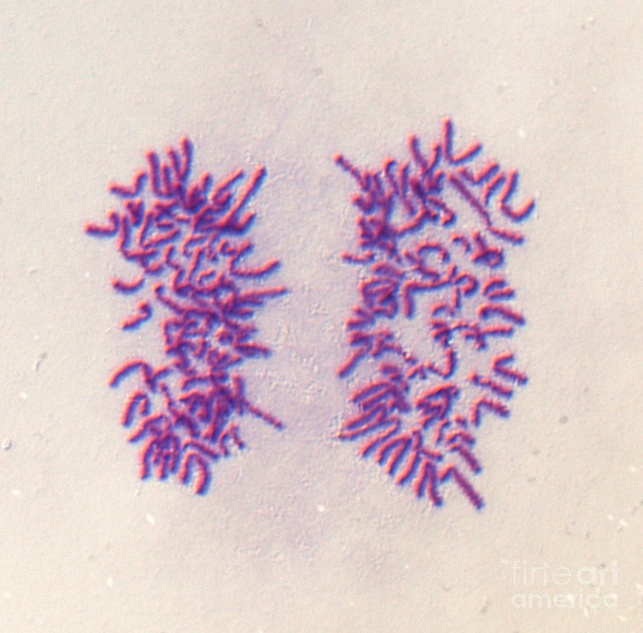 Mitosis #9 Photograph by Dr. Juan F. Gimenez-abian / Science Photo Library