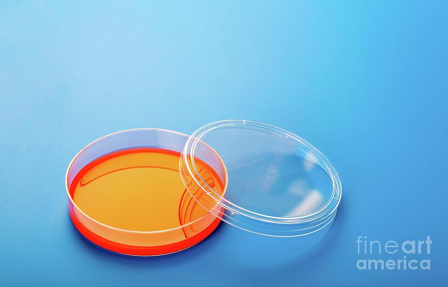 https://images.fineartamerica.com/images/artworkimages/mediumlarge/2/9-petri-dishes-with-blood-agar-wladimir-bulgarscience-photo-library.jpg