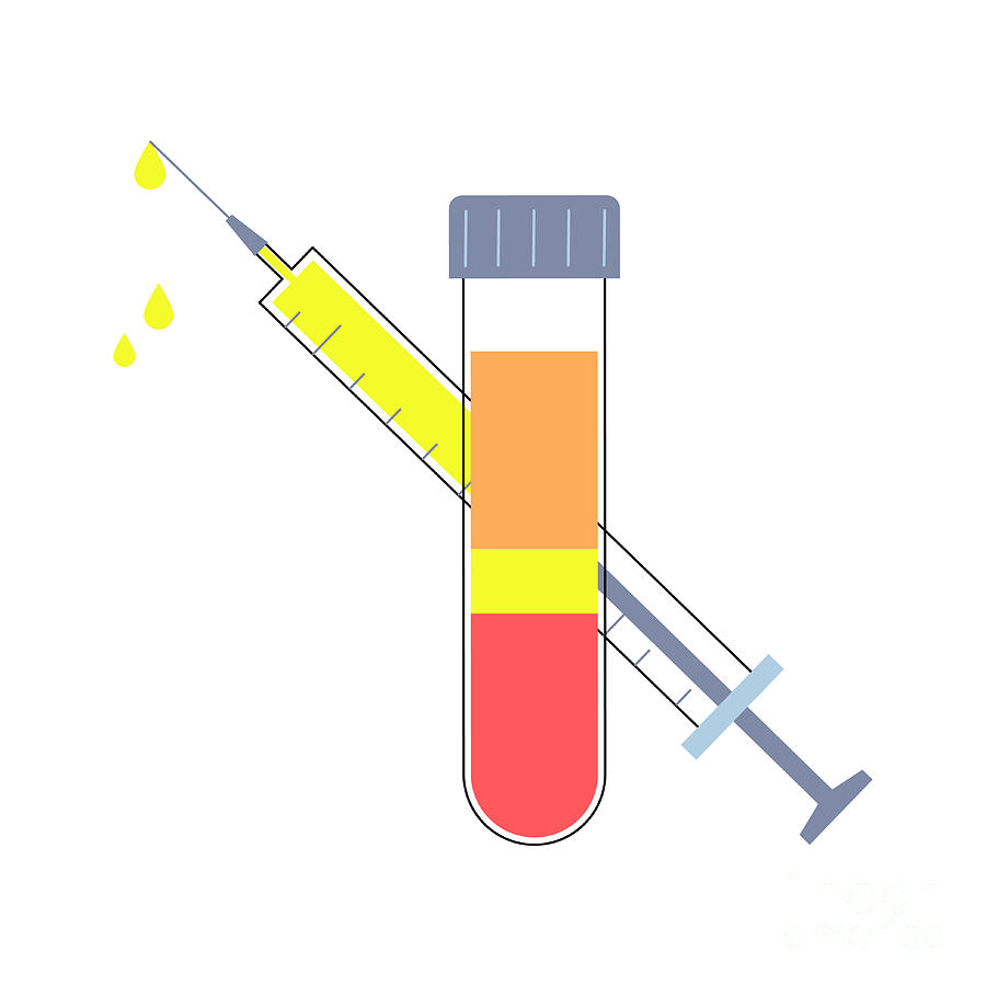 Prp Photograph - Platelet Rich Plasma Therapy #9 by Pikovit / Science Photo Library