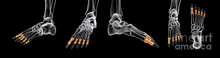 Proximal Phalange Bones Of The Foot Photograph by Kateryna Kon/science ...