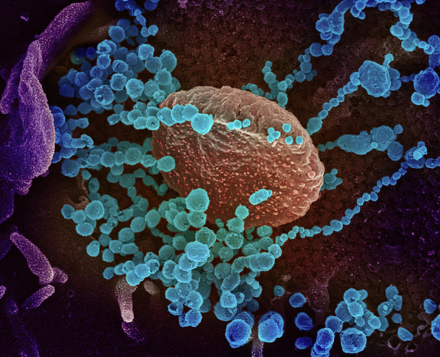 Sars-cov-2, Covid-19 Virus, Sem #9 Photograph by Science Source