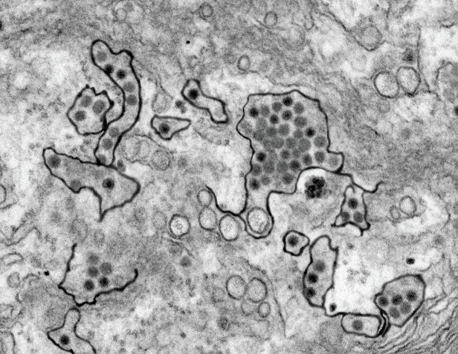 Zika Virus, Tem #9 Photograph by Science Source