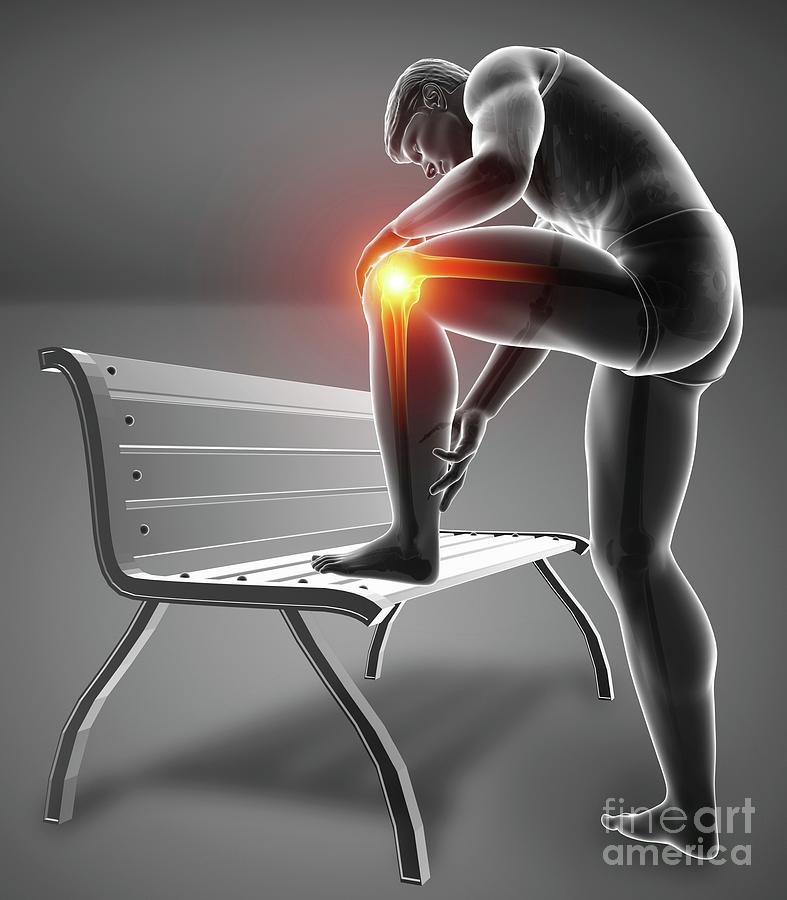 Man With Knee Pain #90 Photograph by Pixologicstudio/science Photo Library