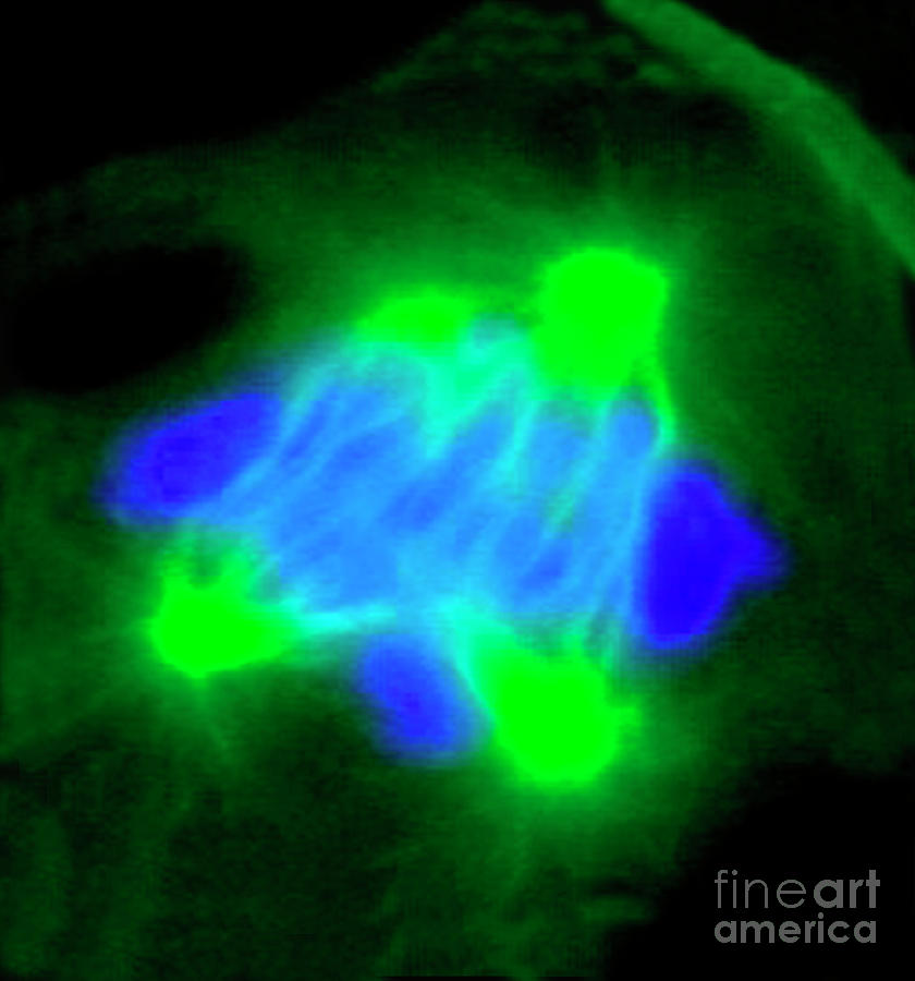 Abnormal Mitosis Photograph by Pascal Goetgheluck/science Photo Library